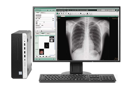 【画像】X線画像診断システム・医療用画像管理システム（PACS）